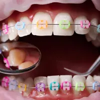 ارتودنسی با تخفیف ۱۰ میلیونی و اقساطی بدون سود|خدمات آرایشگری و زیبایی|شیراز, معالی‌آباد|دیوار