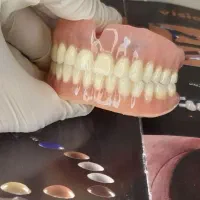 دندان مصنوعی پروتز کامل 18میلیون زیبایی دندان پزشک|خدمات آرایشگری و زیبایی|رشت, قاسمیه|دیوار