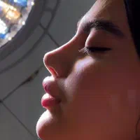 جراحی بینی ابدو‌ساکشن بلفارو(پلک) تیپ پلاستی کاشت|خدمات آرایشگری و زیبایی|مشهد, سجاد شهر|دیوار