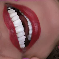 ایمپلنت بلندمدت/کامپوزیت/لمینت/درمانی|خدمات آرایشگری و زیبایی|مرند, |دیوار