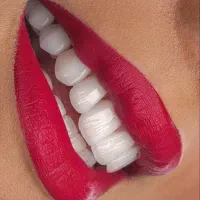 جشنواره کامپوزیت لمینیت روکش عصب ونیر بریدج ترمیم|خدمات آرایشگری و زیبایی|تهران, هفت حوض|دیوار