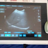 دستگاههای سونوگرافی کالرداپلر