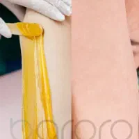 خدمات اپیلاسیون