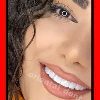 دندانپزشکی کامپوزیت/عصبکشی/ترمیم دندان/روکش بریج|خدمات آرایشگری و زیبایی|تهران, میدان ولیعصر|دیوار