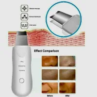 دستگاه اتو صورت برند الترا سونیک‌شاول|آرایشی، بهداشتی، درمانی|تهران, شهرک آزمایش|دیوار