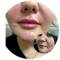 خدمات زیبایی ژل و بوتاکس|خدمات آرایشگری و زیبایی|اردبیل, |دیوار