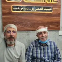 کاشت مو، ابرو، ریش|خدمات آرایشگری و زیبایی|شیراز, باغ تخت|دیوار