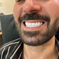 ساخت انواع دندان مصنوعی + لابراتوار دندانساری|خدمات آرایشگری و زیبایی|تهران, یافت آباد جنوبی|دیوار