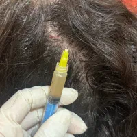 معجزه پوست و مو با پی ار پی|خدمات آرایشگری و زیبایی|خرمشهر, |دیوار