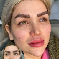 ژل لب|خدمات آرایشگری و زیبایی|شیروان (خراسان), |دیوار