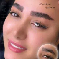 میکروبلیدینگ فیبروز میکروپیگمنتیشن