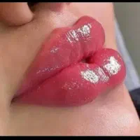 خدمات ژل فیلربوتاکس مزوژل درکلینیک با اف ویژه