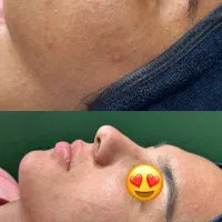 فیشیال و تجویز روتین پوستی اختصاصی رایگان|خدمات آرایشگری و زیبایی|یزد, |دیوار