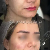 منشی کلینیک زیبایی و لیزر|استخدام درمانی، زیبایی، بهداشتی|رباط‌کریم, |دیوار