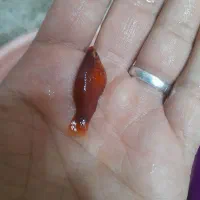 پلاتی بالن خونی رسید