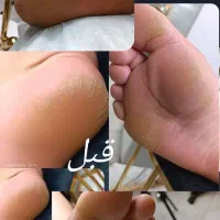 تخفیف ویژه پارافین تراپی دست و پا همراه کف سابی پا|خدمات آرایشگری و زیبایی|یزد, |دیوار