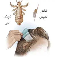 پاکسازی مو از شپش «تضمینی»|خدمات آرایشگری و زیبایی|قم, تولید دارو و یخچال|دیوار