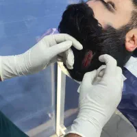 پانسمان پیشرفته ( بخیه ) حرفه ای