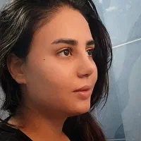 جراحی بینی درتهران/پذیرش مراجعین بهار/42میلیون