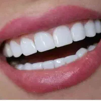 ارتودنسی، کامپوزیت، ترمیم طرف بیمه ها(اقساط)|خدمات آرایشگری و زیبایی|بم, |دیوار