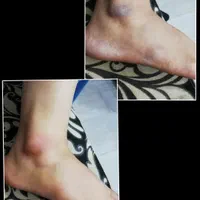 ازبین بردن تیرگی ،ازبین بردن ترک عمیق پا|خدمات آرایشگری و زیبایی|بوشهر, |دیوار