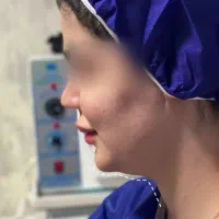 ساکشن غبغب|خدمات آرایشگری و زیبایی|یاسوج, |دیوار