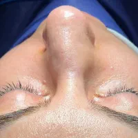 تخفیف ویژه جراحی بینی همین حالا|خدمات آرایشگری و زیبایی|تهران, ازگل|دیوار