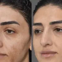 خاویارتراپی لک دست و صورت