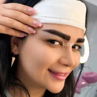 کاشت ابرو نچرال