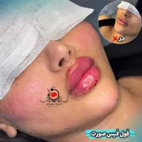 توجشنواره ژل ازسی سی۸۶۰