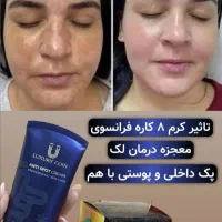 غول ۸ کاره فرانسوی