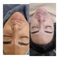 تخفیف ویژه فیشال وی ای پی فقط 550 محدود