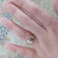 فروش فوری حلقه