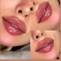 تزریق ژل فیلربوتاکس تخفیفات50درصدی برای زیباجویان|خدمات آرایشگری و زیبایی|زاهدان, |دیوار