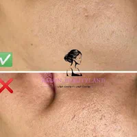 پاکسازی و فیشال آقایان و بانوان توسط پیراپزشک|خدمات آرایشگری و زیبایی|گلبهار, شهر جدید گلبهار|دیوار