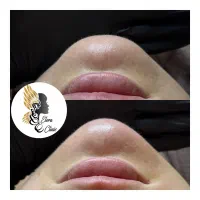 زیبایی ماندگار با خدمات تخصصی ژل و بوتاکس|خدمات آرایشگری و زیبایی|صدرا-فارس, فاز ۱|دیوار