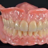 ساخت انواع دندان مصنوعی