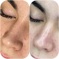 پاکسازی فقط300