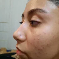 خدمات پیرسینگ و میکرودرمال