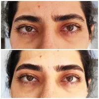 اصلاح ابرو سارا آخوندی هاشمیه تخفیف ویژه