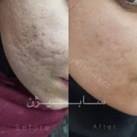 خدمات زیبایی دکتر سجاد جلیلی فرد|خدمات آرایشگری و زیبایی|مسجد سلیمان, |دیوار