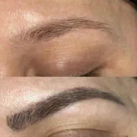 پاک کردن تتو با پیشرفته ترین لیزر کیوسوئیچ|خدمات آرایشگری و زیبایی|اهواز, کوی سعدی|دیوار