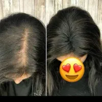 فرمول مو و ابرو