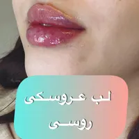 ساکشن غبغب بلفاروپلاستی ژل بوتاکس پی ار پی