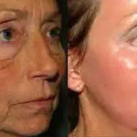 جوانسازی|آرایشی، بهداشتی، درمانی|شیراز, عفیف‌آباد|دیوار