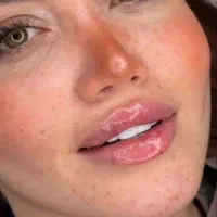 ژل،فیلر،بوتاکس،فیلر بادی باکیفیت بالا و تخفیف ویژه