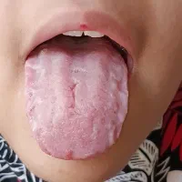 بلاخره مشکل یبوست وکبد چرب حل شد