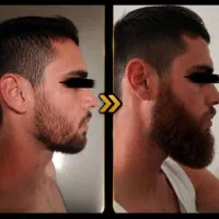ریش و سبیل ترکی