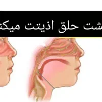 خلط پشت حلق