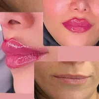 تزریق و تخلیه چربی